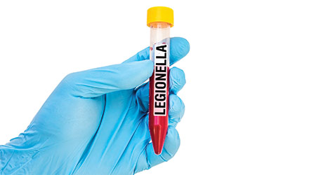 Legionella