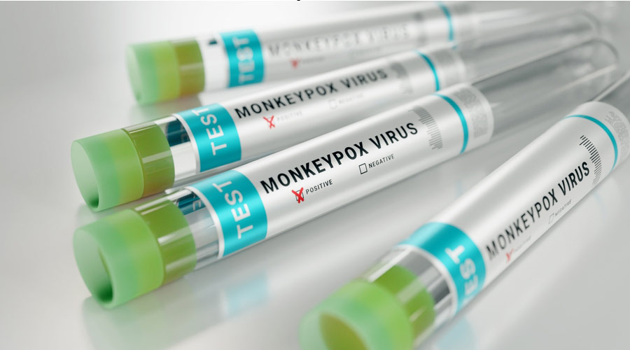 Monkeypox virus test tube on shiny table testing to prevent pandemic. 3D Rendering